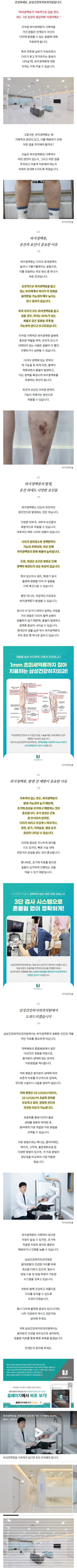 하지정맥류병원추천 maril