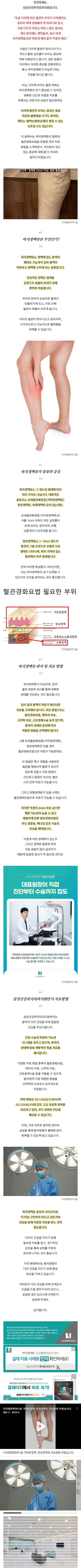 다리하지정맥 pvwkp