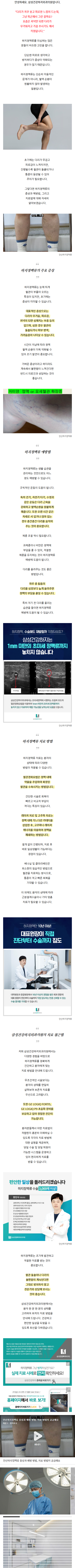 하지정맥류병원추천 cwldz