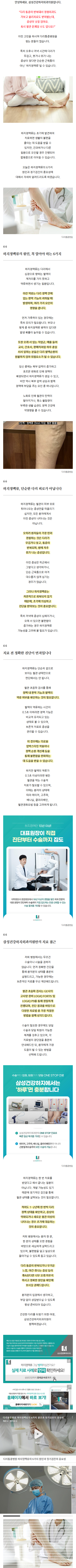 하지정맥류병원추천 xusoq