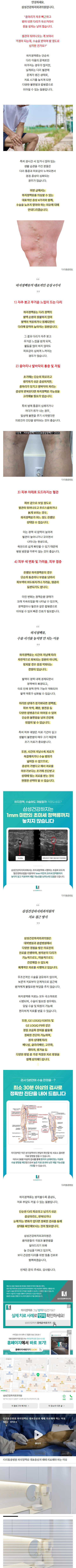 하지정맥류병원추천 rdwgb