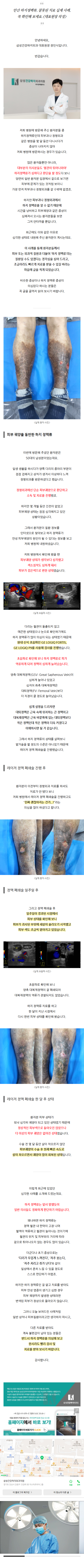 하지정맥류병원추천 kjywe
