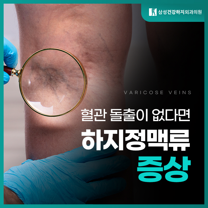 종아리핏줄