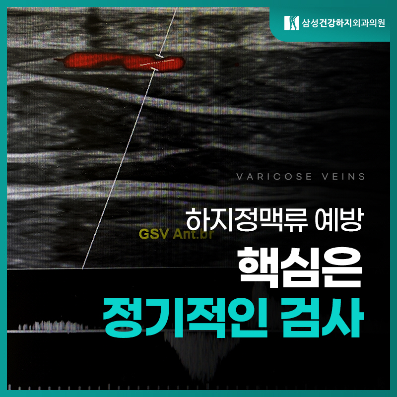 다리하지정맥